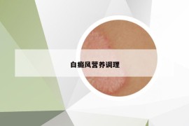 白癜风营养调理