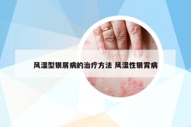 风湿型银屑病的治疗方法 风湿性银霄病