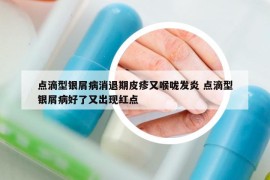 点滴型银屑病消退期皮疹又喉咙发炎 点滴型银屑病好了又出现红点