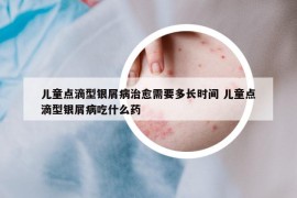 儿童点滴型银屑病治愈需要多长时间 儿童点滴型银屑病吃什么药