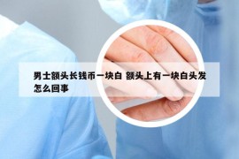 男士额头长钱币一块白 额头上有一块白头发怎么回事