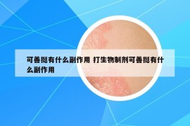 可善挺有什么副作用 打生物制剂可善挺有什么副作用