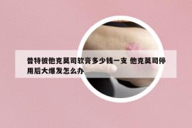 普特彼他克莫司软膏多少钱一支 他克莫司停用后大爆发怎么办