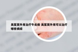 吴茱萸外用治疗牛皮癣 吴茱萸外用可以治疗哪些病症