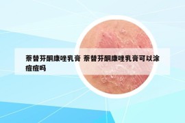 萘替芬酮康唑乳膏 萘替芬酮康唑乳膏可以涂痘痘吗