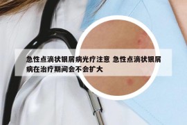 急性点滴状银屑病光疗注意 急性点滴状银屑病在治疗期间会不会扩大