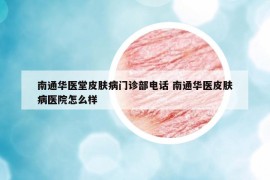 南通华医堂皮肤病门诊部电话 南通华医皮肤病医院怎么样