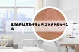 生物制剂主要治疗什么病 生物制剂能治什么病