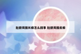 肚脐周围长癣怎么回事 肚脐周围皮癣