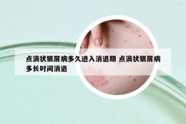 点滴状银屑病多久进入消退期 点滴状银屑病多长时间消退