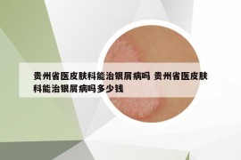 贵州省医皮肤科能治银屑病吗 贵州省医皮肤科能治银屑病吗多少钱