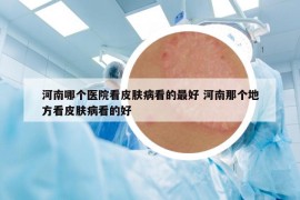 河南哪个医院看皮肤病看的最好 河南那个地方看皮肤病看的好