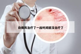 白癜风治疗了一段时间就没治疗了