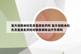 复方倍他米松乳膏是激素药吗 复方倍他米松乳膏是激素药吗对银屑病有治疗作用吗