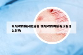 吸烟对白癜风的危害 抽烟对白斑病有没有什么影响