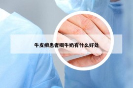 牛皮癣患者喝牛奶有什么好处