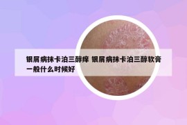 银屑病抹卡泊三醇痒 银屑病抹卡泊三醇软膏一般什么时候好