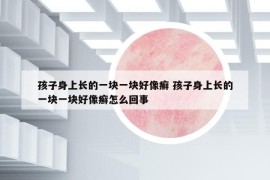 孩子身上长的一块一块好像癣 孩子身上长的一块一块好像癣怎么回事