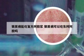 银屑病能吃复方阿胶浆 银屑病可以吃东阿阿胶吗