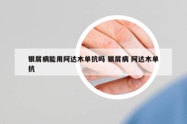 银屑病能用阿达木单抗吗 银屑病 阿达木单抗