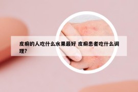 皮癣的人吃什么水果最好 皮癣患者吃什么调理?