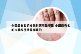 全国最有名的皮肤科医院是哪里 全国最有名的皮肤科医院是哪里的