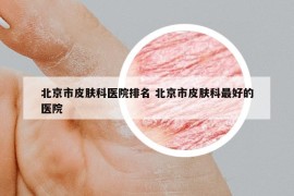 北京市皮肤科医院排名 北京市皮肤科最好的医院