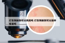 打生物制剂可以同房吗 打生物制剂可以接种疫苗吗