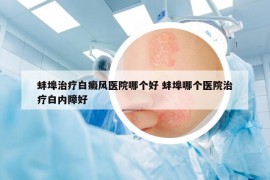 蚌埠治疗白癜风医院哪个好 蚌埠哪个医院治疗白内障好