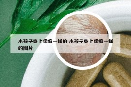 小孩子身上像癣一样的 小孩子身上像癣一样的图片