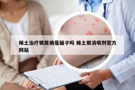 稀土治疗银屑病是骗子吗 稀土银消喷剂官方网站