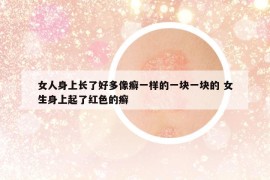 女人身上长了好多像癣一样的一块一块的 女生身上起了红色的癣