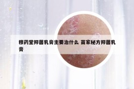 穆药堂抑菌乳膏主要治什么 苗家秘方抑菌乳膏