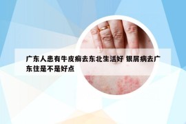 广东人患有牛皮癣去东北生活好 银屑病去广东住是不是好点