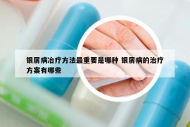 银屑病冶疗方法最重要是哪种 银屑病的治疗方案有哪些