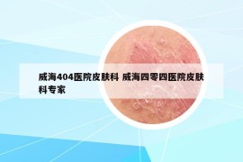 威海404医院皮肤科 威海四零四医院皮肤科专家