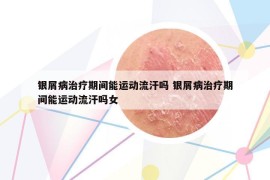 银屑病治疗期间能运动流汗吗 银屑病治疗期间能运动流汗吗女