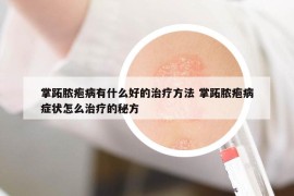 掌跖脓疱病有什么好的治疗方法 掌跖脓疱病症状怎么治疗的秘方