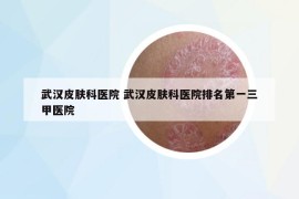 武汉皮肤科医院 武汉皮肤科医院排名第一三甲医院