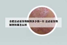 合肥达必妥生物制剂多少钱一针 达必妥生物制剂效果怎么样