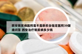 西安银屑病医院是不是新农合指定医院39健康问答 西安治疗银屑病多少钱