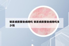 银屑病需要做病理吗 银屑病需要做病理吗多少钱