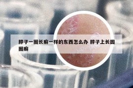 脖子一圈长癣一样的东西怎么办 脖子上长圆圈癣