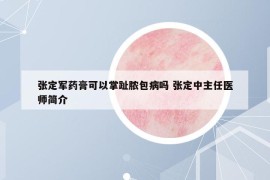 张定军药膏可以掌趾脓包病吗 张定中主任医师简介