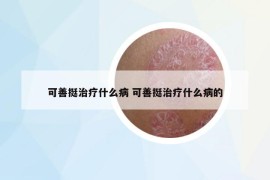 可善挺治疗什么病 可善挺治疗什么病的