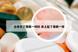 全身长了像癣一样的 身上起了像癣一样