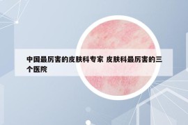 中国最厉害的皮肤科专家 皮肤科最厉害的三个医院