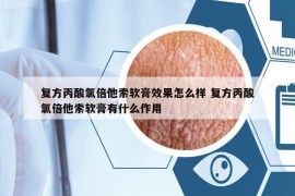 复方丙酸氯倍他索软膏效果怎么样 复方丙酸氯倍他索软膏有什么作用