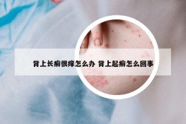 背上长癣很痒怎么办 背上起癣怎么回事