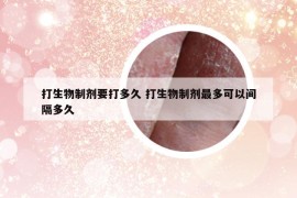 打生物制剂要打多久 打生物制剂最多可以间隔多久